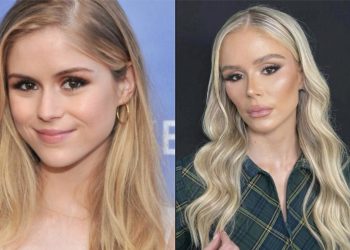 Erin Moriarty Faces Complications After Multiple Facial Surgeries